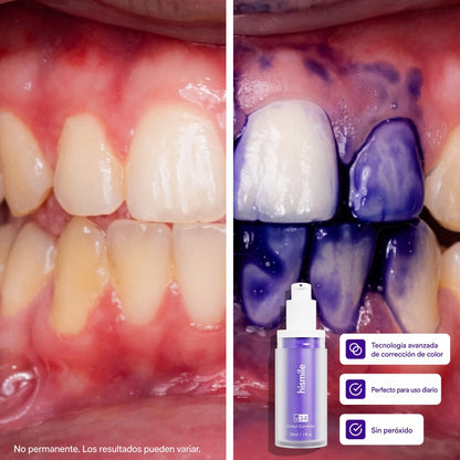 Hismile Blanqueador Dental