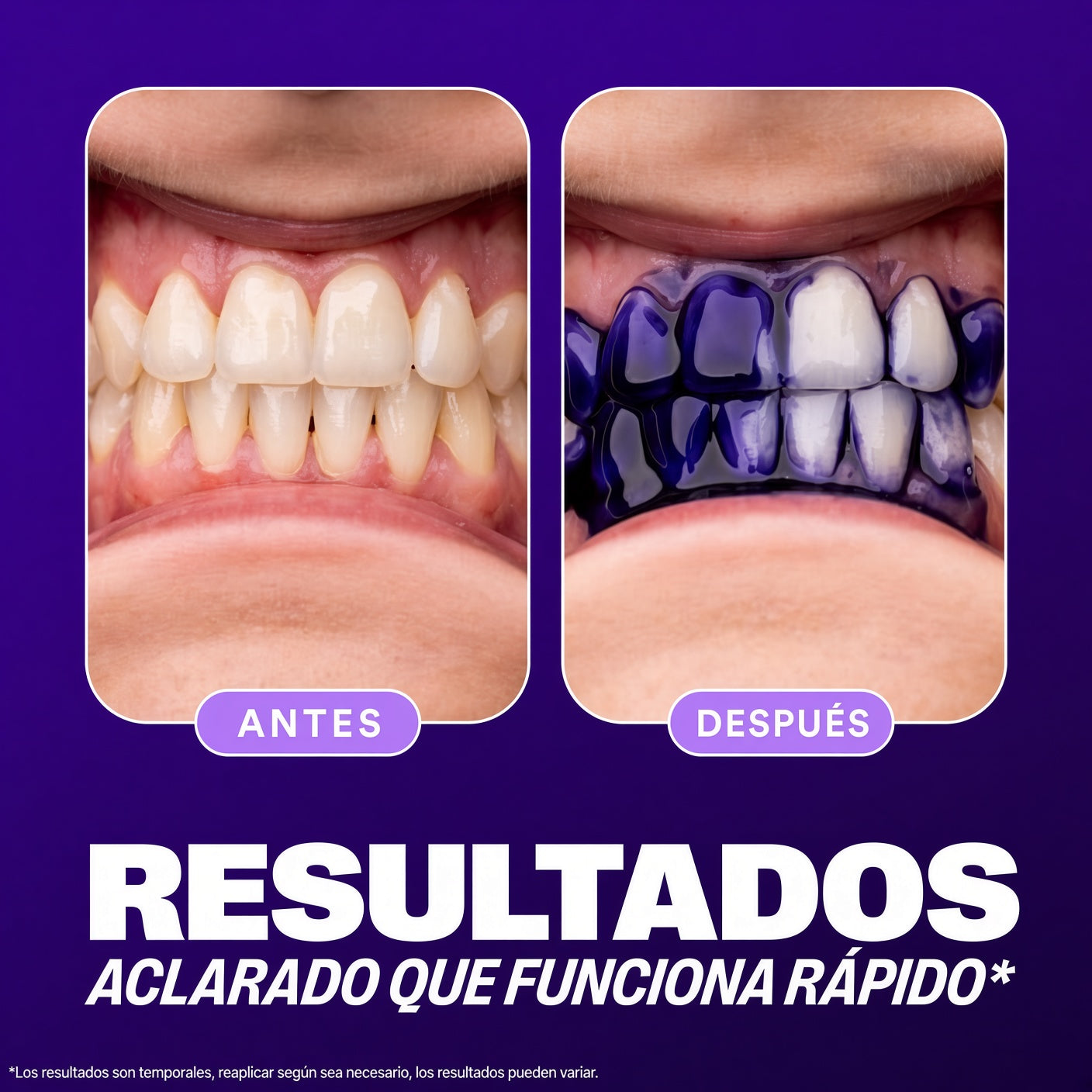Hismile Blanqueador Dental
